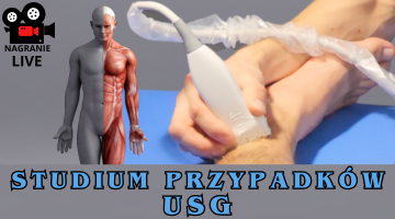 Studium przypadków uczestników kursów USG w MedPower & FizjoLider