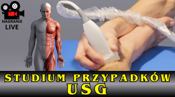 Studium przypadków uczestników kursów USG w MedPower & FizjoLider